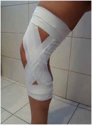 Taping – plastrowanie rehabilitacyjne w ortopedii i fizjoterapii
